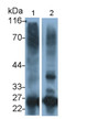 Western Blot; Sample: Lane1: Porcine Liver lysate; Lane2: Porcine Spleen lysate Primary Ab: 0.2ug/ml Mouse Anti-Human CTSS Antibody Second Ab: 0.2ug/mL HRP-Linked Caprine Anti-Mouse IgG Polyclonal Antibody