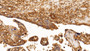 DAB staining on IHC-P; Sample: Human Placenta Tissue; Primary Ab: 5ug/ml Mouse Anti-Human INSR Antibody; Second Ab: 2ug/mL HRP-Linked Caprine Anti-Mouse IgG Polyclonal Antibody
