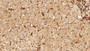 DAB staining on IHC-P; Sample: Human Liver Tissue; Primary Ab: 5ug/ml Mouse Anti-Human INSR Antibody; Second Ab: 2ug/mL HRP-Linked Caprine Anti-Mouse IgG Polyclonal Antibody