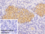 DAB staining on IHC-P; Sample: Rat Pancreas Tissue; Primary Ab: 20ug/ml Rabbit Anti-Mouse GSN Antibody; Control: Used PBS instead of primary antibody; Second Ab: 2ug/ml HRP-Linked Caprine Anti-Rabbit IgG Polyclonal Antibody