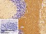 DAB staining on IHC-P; Sample: Rat Cerebellum Tissue; Primary Ab: 20ug/ml Rabbit Anti-Mouse TUBb1 Antibody; Control: Used PBS instead of primary antibody; Second Ab: 2ug/ml HRP-Linked Caprine Anti-Rabbit IgG Polyclonal Antibody