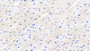 DAB staining on IHC-P; Sample: Human Cardiac Muscle Tissue; Primary Ab: 20ug/ml Mouse Anti-Human GAL1 Antibody Second Ab: 2ug/mL HRP-Linked Caprine Anti-Mouse IgG Polyclonal Antibody