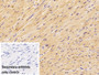 DAB staining on IHC-P; Sample: Rat Cardiac Muscle Tissue; Primary Ab: 10ug/ml Rabbit Anti-Mouse CKM Antibody; Control: Used PBS instead of primary antibody; Second Ab: 2ug/ml HRP-Linked Caprine Anti-Rabbit IgG Polyclonal Antibody