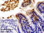 DAB staining on IHC-P; Sample: Mouse Colon Tissue; Primary Ab: 1ug/ml Rabbit Anti-Mouse FABP2 Antibody; Control: Used PBS instead of primary antibody; Second Ab: 2ug/ml HRP-Linked Caprine Anti-Rabbit IgG Polyclonal Antibody