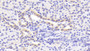 DAB staining on IHC-P; Sample: Human Kidney Tissue; Primary Ab: 20ug/ml Rabbit Anti-Human CCR1 Antibody Second Ab: 2ug/mL HRP-Linked Caprine Anti-Rabbit IgG Polyclonal Antibody