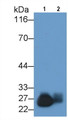 Western Blot; Sample: Lane1: Porcine Pancreas lysate; Lane2: Rat Pancreas lysate Primary Ab: 0.04ug/ml Rabbit Anti-Porcine TRY Antibody Second Ab: 0.2ug/mL HRP-Linked Caprine Anti-Rabbit IgG Polyclonal Antibody