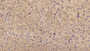 DAB staining on IHC-P; Sample: Mouse Cerebellum Tissue; Primary Ab: 20ug/ml Rabbit Anti-Mouse KISS1R Antibody Second Ab: 2ug/mL HRP-Linked Caprine Anti-Rabbit IgG Polyclonal Antibody