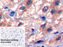 DAB staining on IHC-P; Sample: Human Liver Tissue; Primary Ab: 10ug/ml Mouse Anti-Human F1 2 Antibody; Control: Used PBS instead of primary antibody; Second Ab: 2ug/ml HRP-Linked Caprine Anti-Mouse IgG Polyclonal Antibody