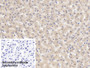 DAB staining on IHC-P; Sample: Human Liver Tissue; Primary Ab: 10ug/ml Mouse Anti-Human F1 2 Antibody; Control: Used PBS instead of primary antibody; Second Ab: 2ug/ml HRP-Linked Caprine Anti-Mouse IgG Polyclonal Antibody