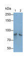 Western Blot; Samples: Lane1: Rabbit Cerebrum lysate; Lane2: Hela cell lysate; Primary Ab: 0.5ug/ml Cavia Anti-Rabbit VCAM1 Antibody; Second Ab: 0.2ug/ml HRP-Linked Rabbit Anti-Cavia IgG Polyclonal Antibody