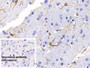 DAB staining on IHC-P; Sample: Mouse Cerebrum Tissue; Primary Ab: 20ug/ml Mouse Anti-Mouse GFAP Antibody; Control: Used PBS instead of primary antibody; Second Ab: 2ug/ml HRP-Linked Caprine Anti-Mouse IgG Polyclonal Antibody