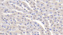DAB staining on IHC-P; Sample: Bovine Liver Tissue; Primary Ab: 20ug/ml Mouse Anti-Bovine aFP Antibody Second Ab: 2ug/mL HRP-Linked Caprine Anti-Mouse IgG Polyclonal Antibody