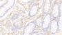 DAB staining on IHC-P; Sample: Human Colon Tissue; Primary Ab: 30ug/ml Mouse Anti-Human NB1 Antibody; Second Ab: 2ug/mL HRP-Linked Caprine Anti-Mouse IgG Polyclonal Antibody