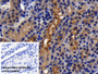DAB staining on IHC-P; Sample: Human Kidney Tissue; Primary Ab: 10ug/ml Mouse Anti-Human ACE2 Antibody; Control: Used PBS instead of primary antibody; Second Ab: 2ug/ml HRP-Linked Caprine Anti-Mouse IgG Polyclonal Antibody