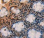 Used in DAB staining on fromalin fixed paraffin-embedded rectum tissue