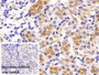 DAB staining on IHC-P; Sample: Rat Kidney Tissue; Primary Ab: 30ug/ml Mouse Anti-Rat LDHB Antibody; Control: Used PBS instead of primary antibody; Second Ab: 2ug/ml HRP-Linked Caprine Anti-Mouse IgG Polyclonal Antibody