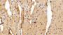 DAB staining on IHC-P; Sample: Human Cardiac Muscle Tissue; Primary Ab: 20ug/ml Mouse Anti-Human FGF1 Antibody; Second Ab: 2ug/mL HRP-Linked Caprine Anti-Mouse IgG Polyclonal Antibody