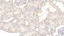 DAB staining on IHC-P; Sample: Human Kidney Tissue; Primary Ab: 20ug/ml Mouse Anti-Human MMP13 Antibody; Second Ab: 2ug/mL HRP-Linked Caprine Anti-Mouse IgG Polyclonal Antibody