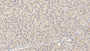 DAB staining on IHC-P; Sample: Human Liver Tissue; Primary Ab: 40ug/ml Mouse Anti-Human MMP13 Antibody; Second Ab: 2ug/mL HRP-Linked Caprine Anti-Mouse IgG Polyclonal Antibody