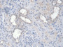 DAB staining on IHC-P; Sample: Human Kidney Tissue; Primary Ab: 30ug/ml Mouse Anti-Human EPO Antibody; Second Ab: 2ug/mL HRP-Linked Caprine Anti-Mouse IgG Polyclonal Antibody