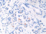 DAB staining on IHC-P; Sample: Human Pancreas Tissue; Primary Ab: 30ug/ml Mouse Anti-Human BNP Antibody Second Ab: 2ug/mL HRP-Linked Caprine Anti-Mouse IgG Polyclonal Antibody