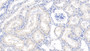 DAB staining on IHC-P; Sample: Human Kidney Tissue; Primary Ab: 10ug/ml Mouse Anti-Human RNASE2 Antibody Second Ab: 2ug/mL HRP-Linked Caprine Anti-Mouse IgG Polyclonal Antibody