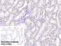 DAB staining on IHC-P; Sample: Human Kidney Tissue; Primary Ab: 10ug/ml Mouse Anti-Human RNASE2 Antibody; Control: Used PBS instead of primary antibody; Second Ab: 2ug/ml HRP-Linked Caprine Anti-Mouse IgG Polyclonal Antibody
