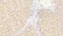 DAB staining on IHC-P; Sample: Human Liver Tissue; Primary Ab: 20ug/ml Mouse Anti-Human WNT11 Antibody Second Ab: 2ug/mL HRP-Linked Caprine Anti-Mouse IgG Polyclonal Antibody