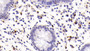 DAB staining on IHC-P; Sample: Human Colon Tissue; Primary Ab: 40ug/ml Mouse Anti-Human CD8a Antibody; Second Ab: 2ug/mL HRP-Linked Caprine Anti-Mouse IgG Polyclonal Antibody
