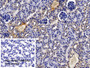 DAB staining on IHC-P; Sample: Mouse Kidney Tissue; Primary Ab: 20ug/ml Rabbit Anti-Mouse C1INH Antibody; Control: Used PBS instead of primary antibody; Second Ab: 2ug/ml HRP-Linked Caprine Anti-Rabbit IgG Polyclonal Antibody