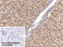 DAB staining on IHC-P; Sample: Human Liver Tissue; Primary Ab: 20ug/ml Mouse Anti-Human ANG Antibody; Control: Used PBS instead of primary antibody; Second Ab: 2ug/ml HRP-Linked Caprine Anti-Mouse IgG Polyclonal Antibody