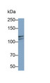 Western Blot; Sample: K562 cell lysate Primary Ab: 0.2ug/ml Mouse Anti-Human IDE Antibody Second Ab: 0.2ug/mL HRP-Linked Caprine Anti-Mouse IgG Polyclonal Antibody