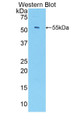 Western Blot; Sample: Recombinant NAP3, Mouse.
