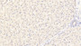 DAB staining on IHC-P; Sample: Human Liver Tissue; Primary Ab: 20ug/ml Mouse Anti-Human SHH Antibody; Second Ab: 2ug/mL HRP-Linked Caprine Anti-Mouse IgG Polyclonal Antibody