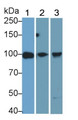 Western Blot; Sample: Lane1: Human Milk; Lane2: Human Lung lysate; Lane3: THP1 cell lysate Primary Ab: 1ug/ml Mouse Anti-Human TLR2 Antibody Second Ab: 0.2ug/mL HRP-Linked Caprine Anti-Mouse IgG Polyclonal Antibody