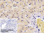 DAB staining on IHC-P; Sample: Human Liver Tissue; Primary Ab: 20ug/ml Mouse Anti-Human S100A9 Antibody; Control: Used PBS instead of primary antibody; Second Ab: 2ug/ml HRP-Linked Caprine Anti-Mouse IgG Polyclonal Antibody