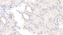 DAB staining on IHC-P; Samples: Human Kidney Tissue; Primary Ab: 20ug/ml Mouse Anti-Human BMP6 Antibody Second Ab: 2ug/mL HRP-Linked Caprine Anti-Mouse IgG Polyclonal Antibody