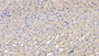 DAB staining on IHC-P; Sample: Rat Cardiac Muscle Tissue; Primary Ab: 20ug/ml Mouse Anti-Human VEGF165 Antibody; Second Ab: 2ug/mL HRP-Linked Caprine Anti-Mouse IgG Polyclonal Antibody