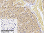 DAB staining on IHC-P; Sample: Human Liver Tissue; Primary Ab: 20ug/ml Mouse Anti-Human S100A9 Antibody; Control: Used PBS instead of primary antibody; Second Ab: 2ug/ml HRP-Linked Caprine Anti-Mouse IgG Polyclonal Antibody