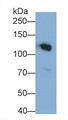 Western Blot; Sample: Human Serum Primary Ab: 0.5ug/ml Mouse Anti-Human C3a Antibody Second Ab: 0.2ug/mL HRP-Linked Caprine Anti-Mouse IgG Polyclonal Antibody
