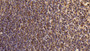 DAB staining on IHC-P; Sample: Human Spleen Tissue; Primary Ab: 10ug/ml Mouse Anti-Human CD4 Antibody Second Ab: 2ug/mL HRP-Linked Caprine Anti-Mouse IgG Polyclonal Antibody