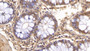 DAB staining on IHC-P; Sample: Human Colon Tissue; Primary Ab: 20ug/ml Mouse Anti-Human Visfatin Antibody; Second Ab: 2ug/mL HRP-Linked Caprine Anti-Mouse IgG Polyclonal Antibody