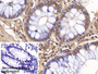 DAB staining on IHC-P; Sample: Human Colon Tissue; Primary Ab: 20ug/ml Mouse Anti-Human VF Antibody; Control: Used PBS instead of primary antibody; Second Ab: 2ug/ml HRP-Linked Caprine Anti-Mouse IgG Polyclonal Antibody