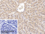 DAB staining on IHC-P; Sample: Human Liver Tissue; Primary Ab: 20ug/ml Mouse Anti-Human VF Antibody; Control: Used PBS instead of primary antibody; Second Ab: 2ug/ml HRP-Linked Caprine Anti-Mouse IgG Polyclonal Antibody