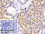 DAB staining on IHC-P; Sample: Porcine Kidney Tissue; Primary Ab: 10ug/ml Rabbit Anti-Porcine IGF1 Antibody; Control: Used PBS instead of primary antibody; Second Ab: 2ug/ml HRP-Linked Caprine Anti-Rabbit IgG Polyclonal Antibody