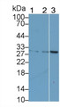 Western Blot; Sample: Lane1: Human Placenta lysate; Lane2: Porcine Lymph node lysate; Lane3: Raji cell lysate Primary Ab: 2ug/ml Mouse Anti-Human CTLA4 Antibody Second Ab: 0.2ug/mL HRP-Linked Caprine Anti-Mouse IgG Polyclonal Antibody