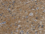 DAB staining on IHC-P; Sample: Human Glioma Tissue; Primary Ab: 20ug/ml Mouse Anti-Human AQP4 Antibody; Second Ab: 2ug/mL HRP-Linked Caprine Anti-Mouse IgG Polyclonal Antibody