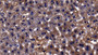 DAB staining on IHC-P; Sample: Mouse Liver Tissue; Primary Ab: 10ug/ml Rabbit Anti-Mouse ACSL1 Antibody Second Ab: 2ug/mL HRP-Linked Caprine Anti-Rabbit IgG Polyclonal Antibody