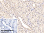 DAB staining on IHC-P; Sample: Human Kidney Tissue; Primary Ab: 20ug/ml Mouse Anti-Human MSRA Antibody; Control: Used PBS instead of primary antibody; Second Ab: 2ug/ml HRP-Linked Caprine Anti-Mouse IgG Polyclonal Antibody