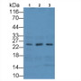 Western Blot; Sample: Lane1: Rat Liver lysate; Lane2: Rat Kidney lysate; Lane3: Porcine Kidney lysate Primary Ab: 3ug/ml Mouse Anti-Human MSRA Antibody Second Ab: 0.2ug/mL HRP-Linked Caprine Anti-Mouse IgG Polyclonal Antibody